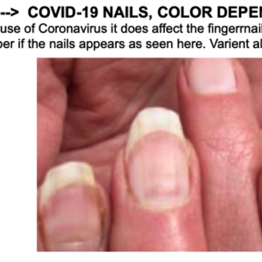 025_07B COVID-19 Nails